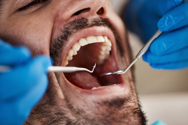 Best Emergency Dental Surgery in Belle, WV